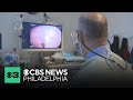 New guidelines for colorectal cancer aim to boost early detection rates