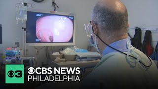 New guidelines for colorectal cancer aim to boost early detection rates