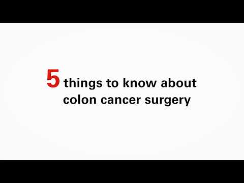 5 things to know about colon cancer surgery