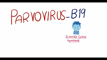 Jaké jsou příčiny páté nemoci?