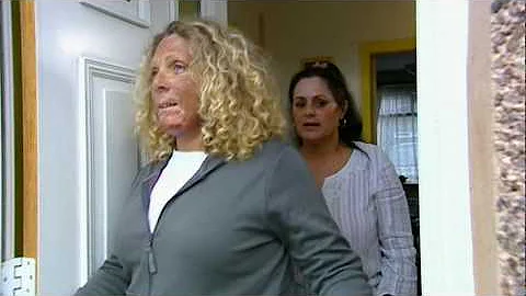 Janice Post-Surgery - 10 Years Younger