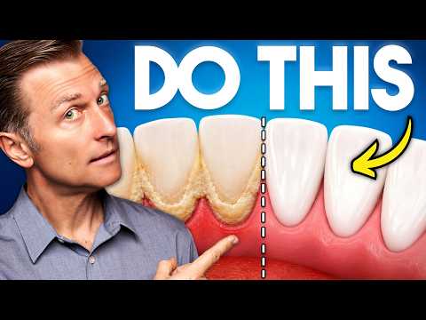 Tartar Keeps Coming Back in the Same Spot? (Here's How to Stop It)