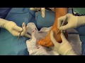 Self Mobi Ankle Varus/Valgus on PP