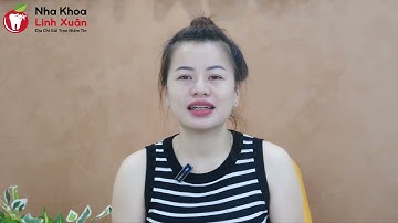[Review niềng răng] - Kết quả niềng răng móm của Thu Thi