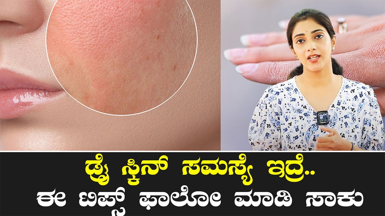 ಒಣ ಚರ್ಮ ಸಮಸ್ಯೆಗೆ ಈ ಮನೆಮದ್ದು ಟ್ರೈ ಮಾಡಿ  | Tips for Preventing Dry Skin | Vijay Karnataka