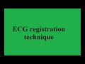 41  ECG registration technique