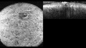 Optical Coherence Tomography Raster of Normal Skin