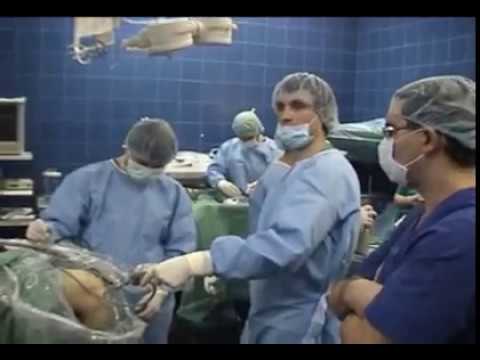 Разрыв Передней Крестообразной Связки (ПКС)-операция