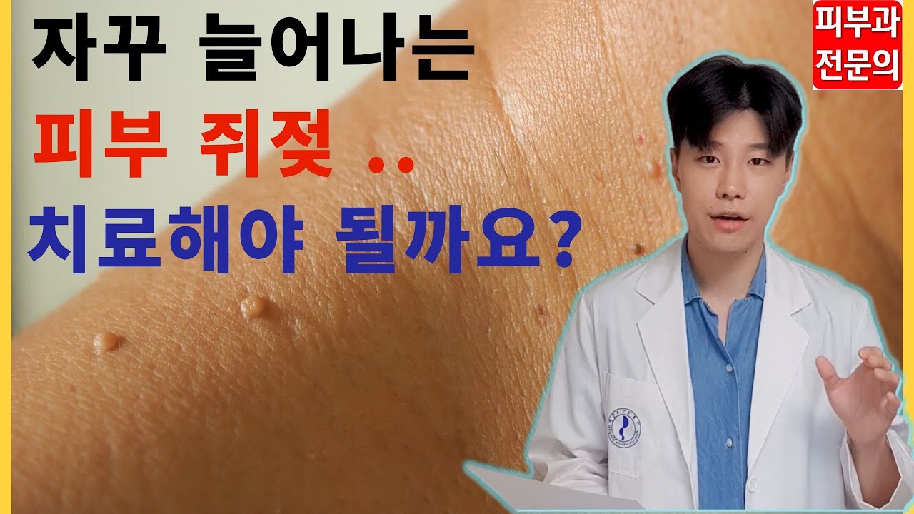 피부 쥐젖의 진단 & 치료 & 재발방지 by 피부과 전문의 - YouTube