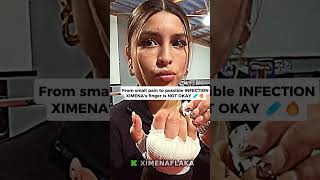 From small pain to possible INFECTION XIMENA’s finger is NOT OKAY 🩹🔥
