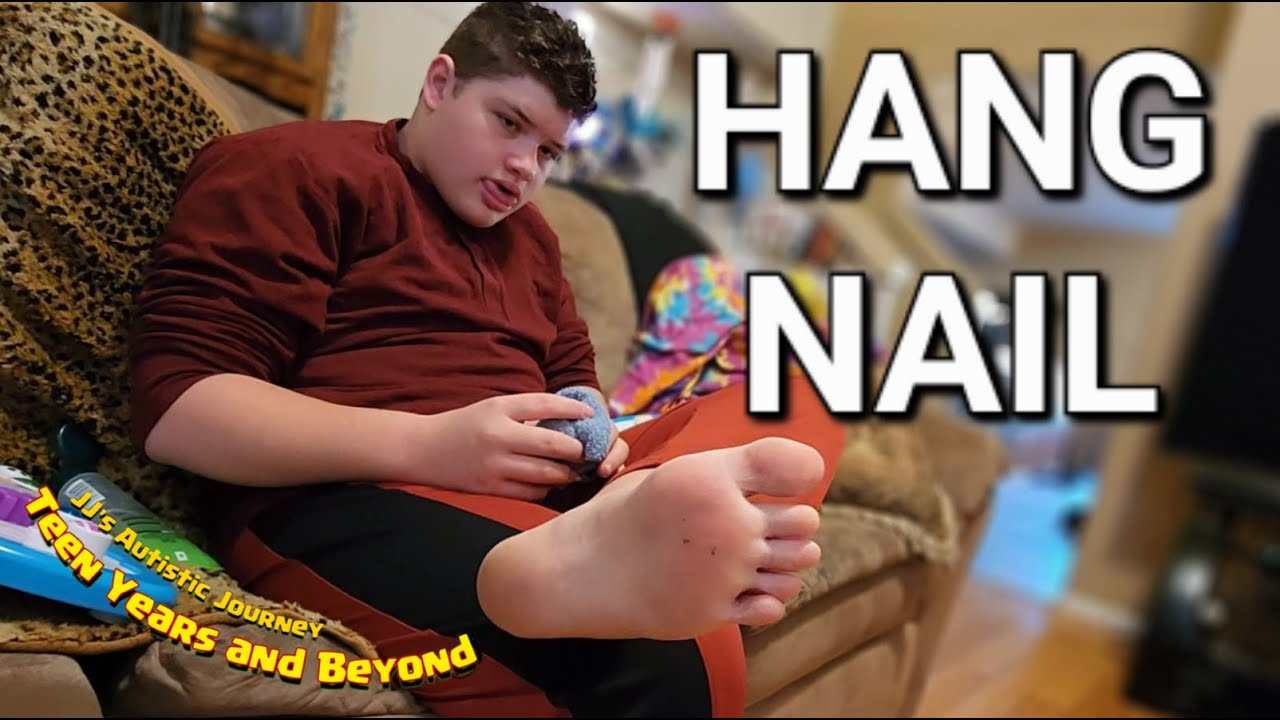 Hang Nail - YouTube