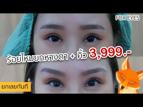 ร้อยไหมยกหางตา + ยกคิ้ว 3,999.- 🔥 บอกเลยว่า "สวย" | FOX EYES~ 👀