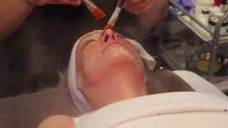 Enzyme Peel with Microdemabrasion
