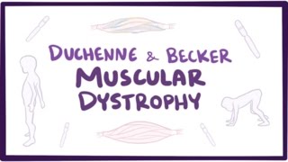 Duchenne & Becker muscular dystrophy  causes, symptoms, treatment & pathology