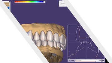 MODJAW BENEFITS - S1E2