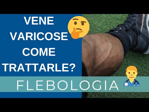 Video: Le Vene Del Ragno Sulle Gambe Cause, Sintomi E Trattamento