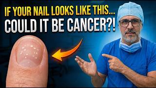 Check Your Nails NOW: 7 Hidden Signs of Deadly Diseases you keep ignoring...