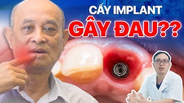 Trồng Răng Implant Có Đau Không? 3 Nguyên Nhân Gây Đau Khi Cấy Ghép| LacVietIntech