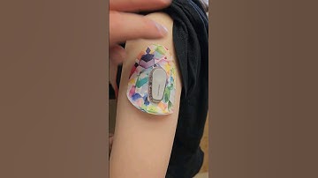 Dexcom Veranderdag #diabetes #typeonediabetes #t1d #dexcom #dexcomg6