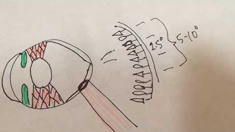 Tactical Scanning Techniques and Blind Spots