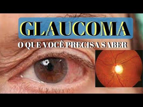 Vídeo: Glaucoma - Sinais, Sintomas, Tratamento, Fases