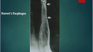 Screencast Images Fluoroscopy