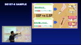 Dr.皆川の 『 リスクを激減させるインプラント埋入法シリーズ