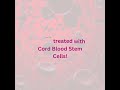 Thalassemia major  cord blood stem cells  stemcyte india