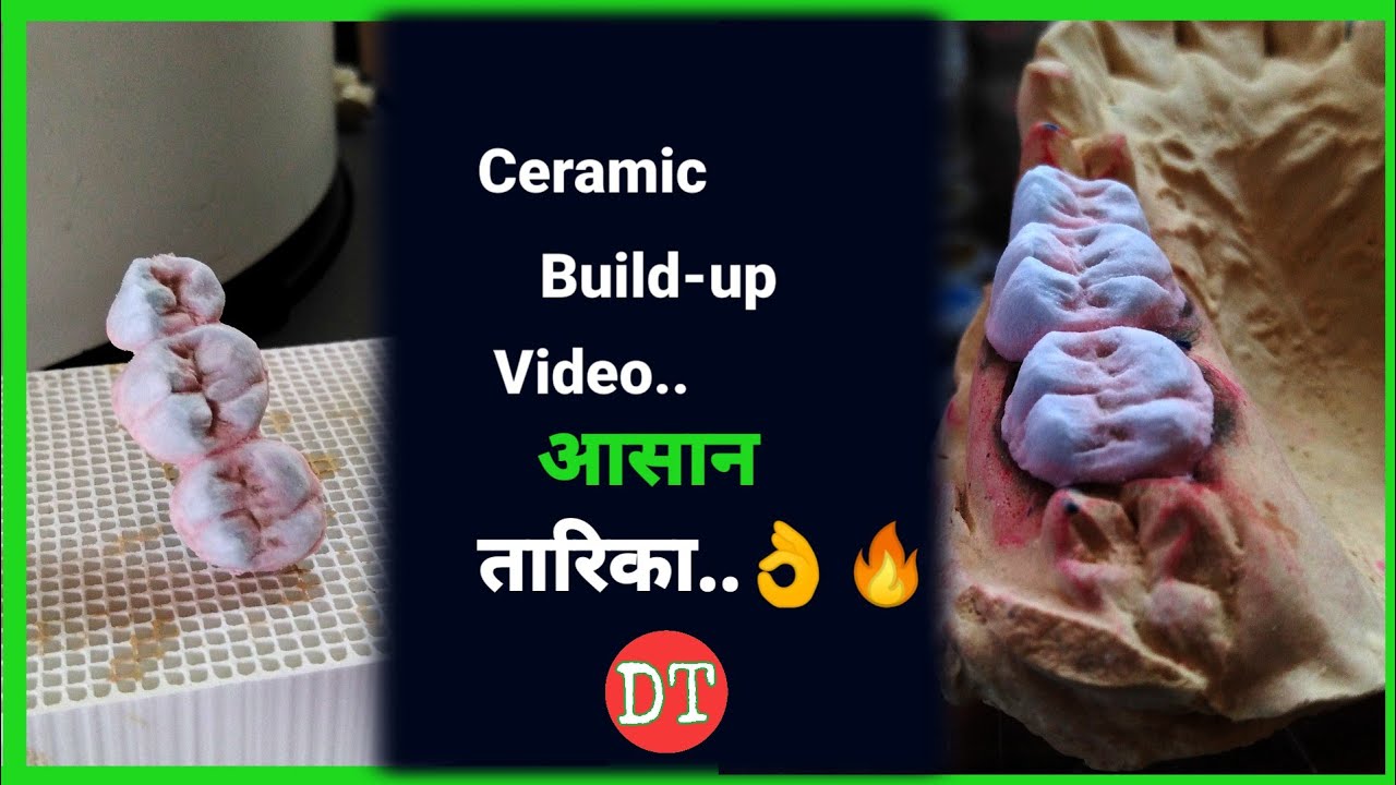 Ceramic Buildup video Build up pfm Dental Technician india Dental