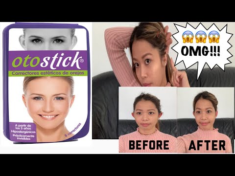 Otostick Ear Correctors First Impression/Demo