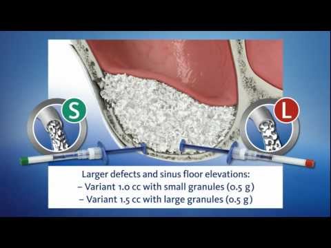 Dental Animation: Geistlich Bio-Oss Pen®