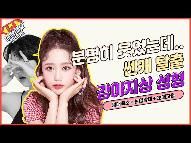 남들한테 오해사는 쎈캐 얼굴 탈출하려면? 선한 인상 강아지상 성형 2편│눈매교정 + 광대축소│부탁해요의느님