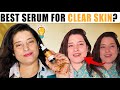 Best Serum for pigmentation and uneven skin tone ?ft Dermatouch