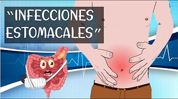 ¿Cuáles son los signos de una infección intestinal?