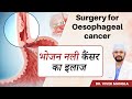 Surgery of Food Pipe Cancer |  फ़ूड पाइप कैंसर की सर्जरी एवं रिकवरी|  Dr Vivek Mangla