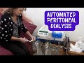 Automated peritonealdialysis tidal peritoneal dialysis  nocturnal peritoneal dialysis