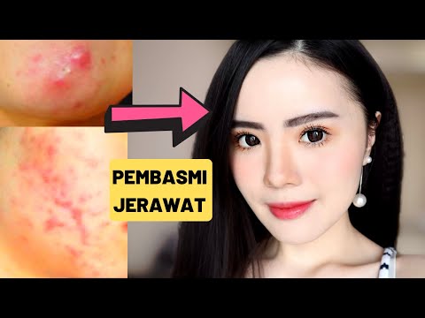 Skincare Routine - Perawatan Wajah Berjerawat Ghostriyo. 