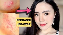 7 MAKANAN WAJIB DIKONSUMSI UNTUK MENGHILANGKAN JERAWAT (PENGALAMANKU) - Durasi: 10.58. 
