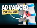 Advanced Exercises to Relieve Sciatica or Sciatic Pain- Herniated Disc