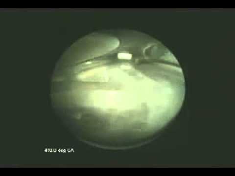Camera inside engine - YouTube