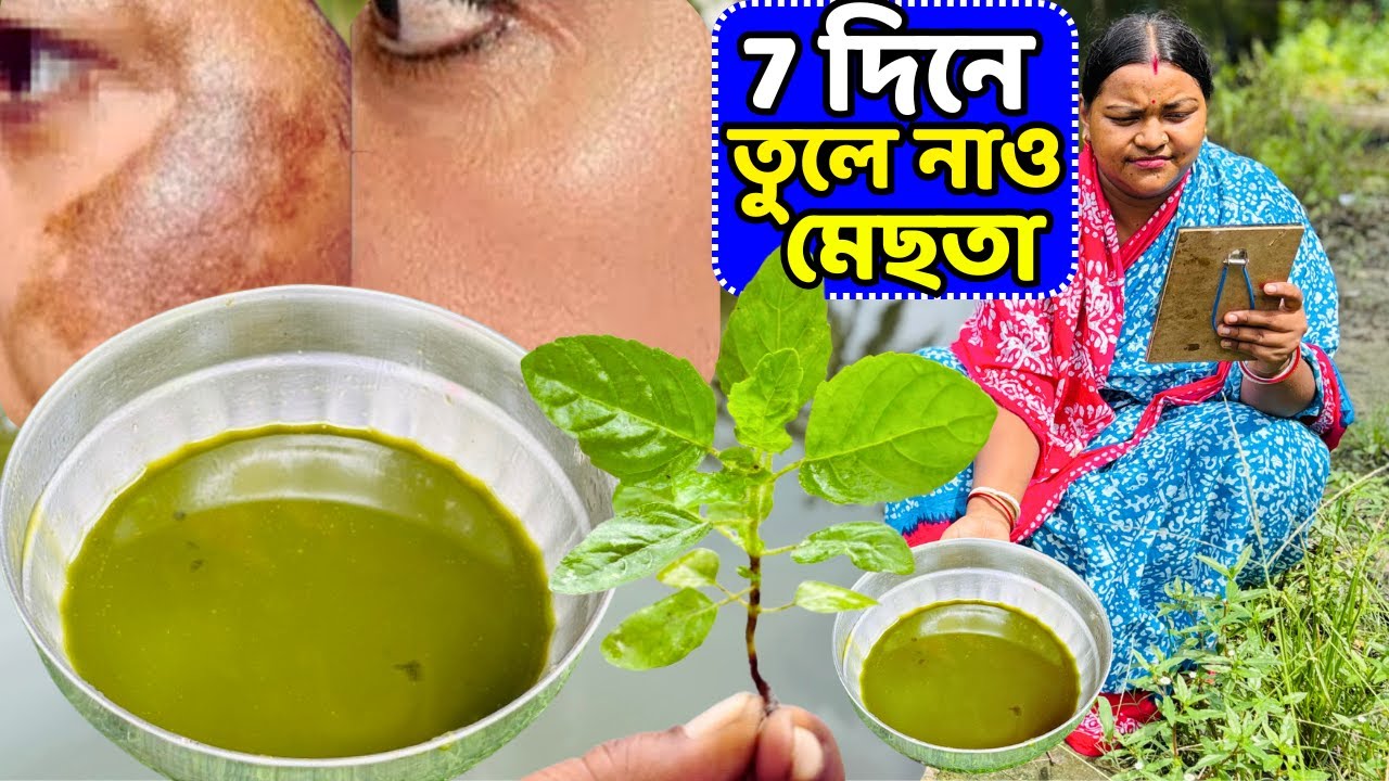 7 দিনে মেছতার দাগ ও যে কোনো কালো দাগ মুছে যাবে এই ফেস প্যাকে