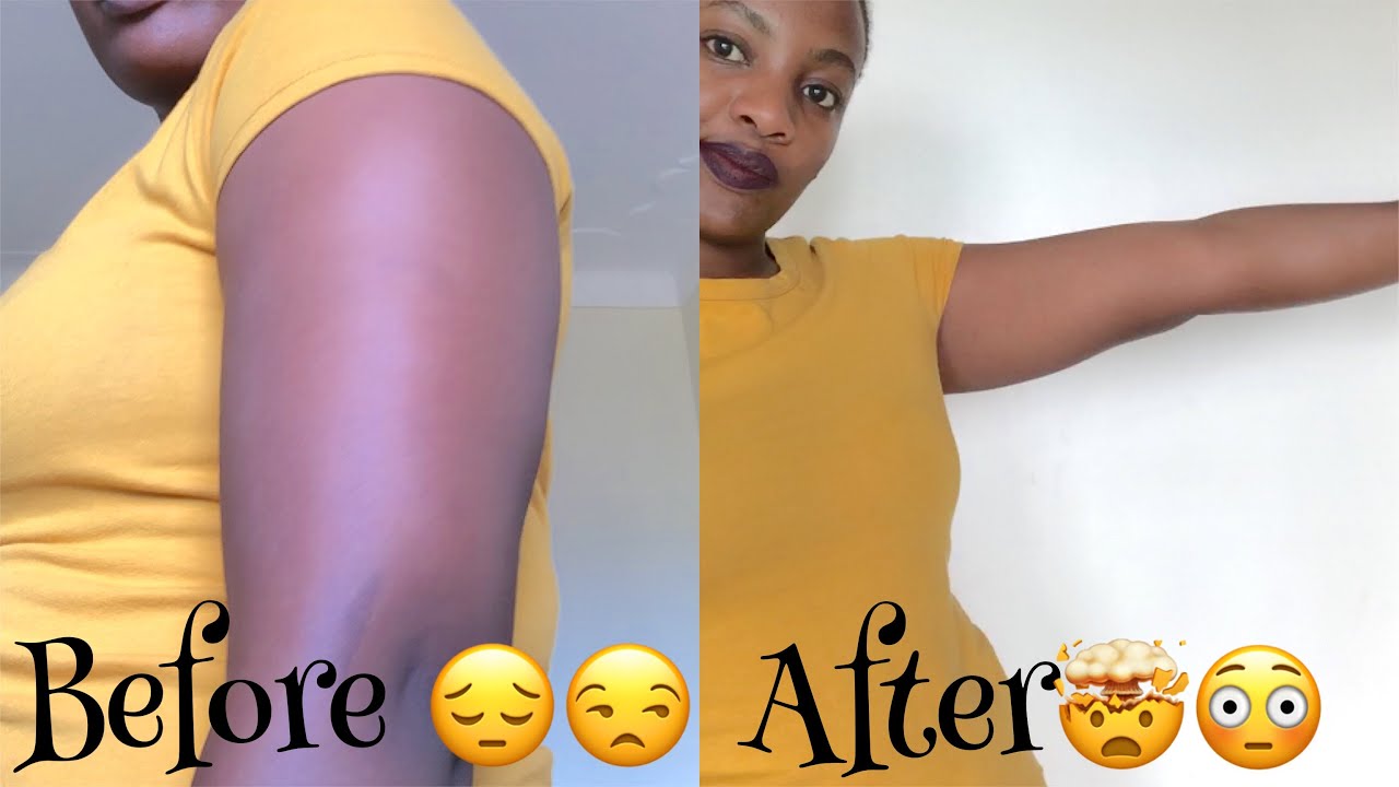 Lean Arms Workout. Before and After results #chloetingchallenge