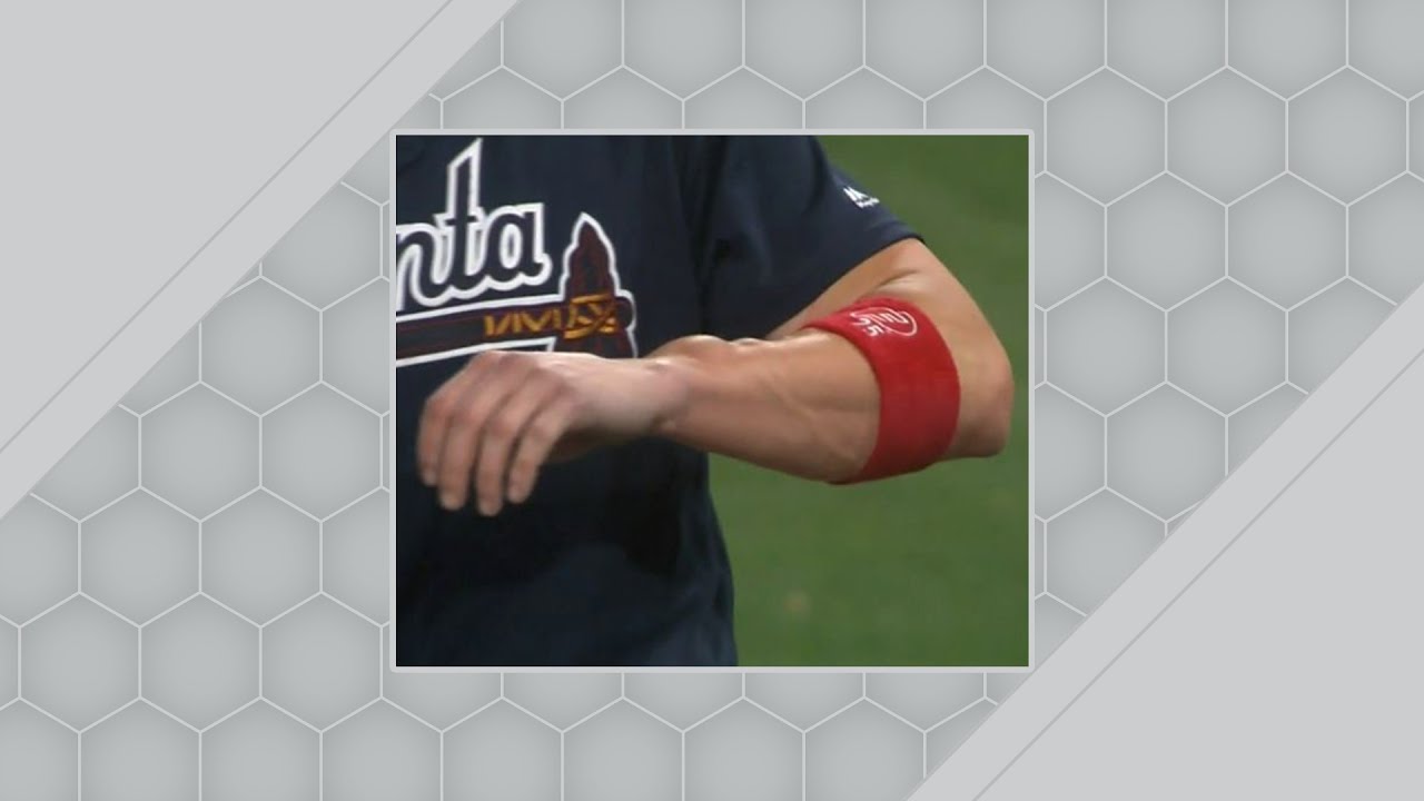 Tyler Flowers' Wrist Blossoms - Get a load of Tyler Flowers' swollen wrist after ge