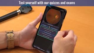 OphthoSim Mobile