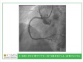 Left main and multivessel coronary disease  dr keyur parikhcims hospital