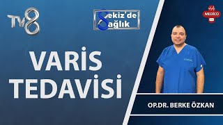 Varisin Belirtileri Nelerdir? | Op. Dr. Berke Özkan | 8'de Sağlık