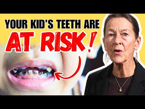 Do Sealants Actually Cause More Cavities?