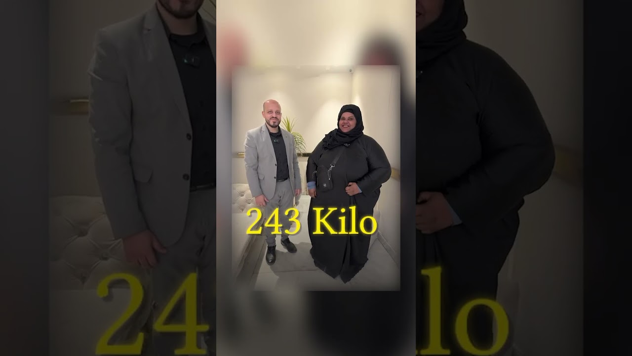 رحلة نجاح جديدة  مع عملية إصلاح التكميم وعمل تحويل مسار والنزول في الوزن بعد 240 كيلو