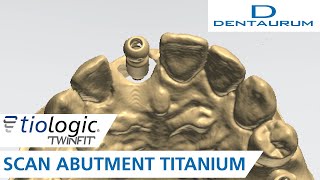 The tioLogic® TWINFIT scan abutment titanium