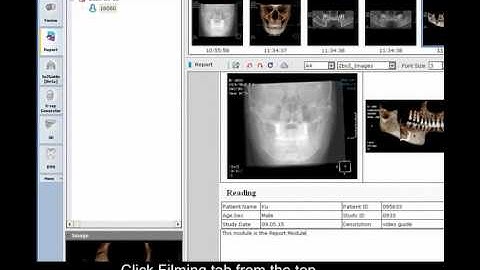 Report Module - Select Template form / Insert / Print